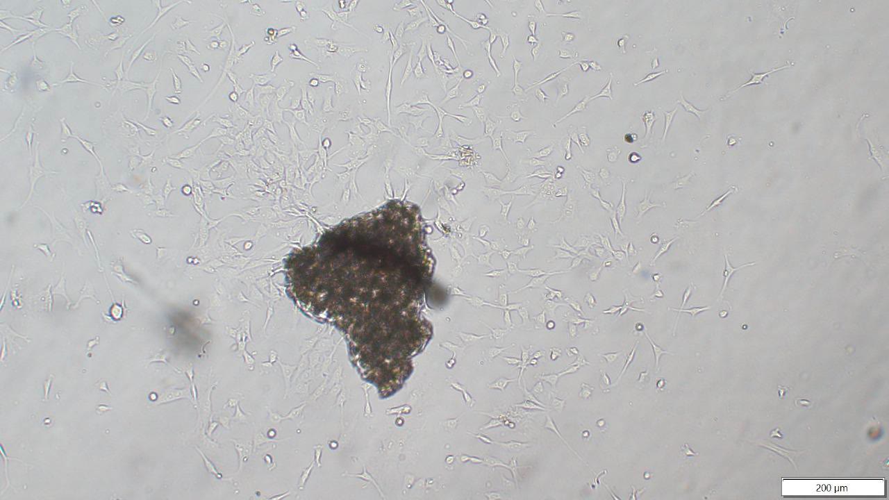 Brightfield micrograph of fibroblasts migrating out of a dark tissue explant, with a 200 micrometre scale bar.
